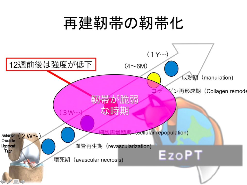 前十字靭帯断裂後のスポーツ復帰 えぞリハセラピストlabo